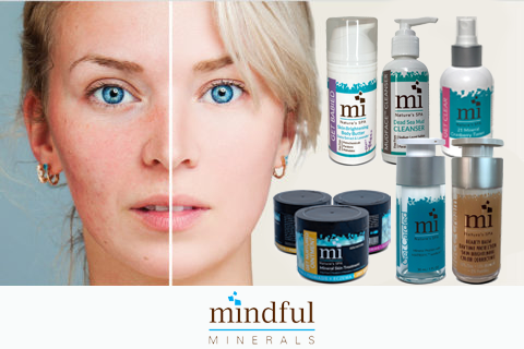 Rosacea Protocol