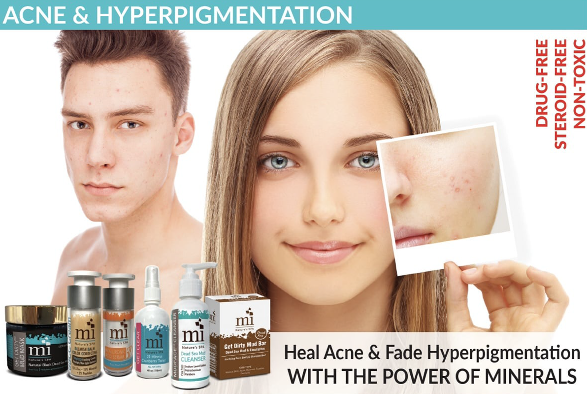 Acne & Hyperpigmentation Protocol